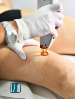 Depilacin laser - Foto 3